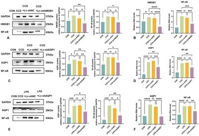 Lentivirus-mediated RNA interference targeting HMGB1 modulates AQP1 to reduce pain induced by chronic compression of the dorsal root ganglia